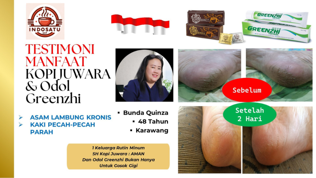 Asam lambung dan kaki pecah pecah