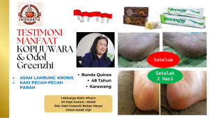 Asam lambung dan kaki pecah pecah