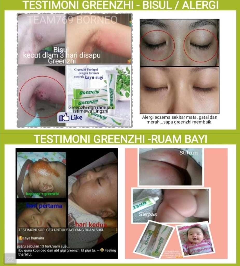 Testimoni Bisul sembuh dengan odol greenzhi